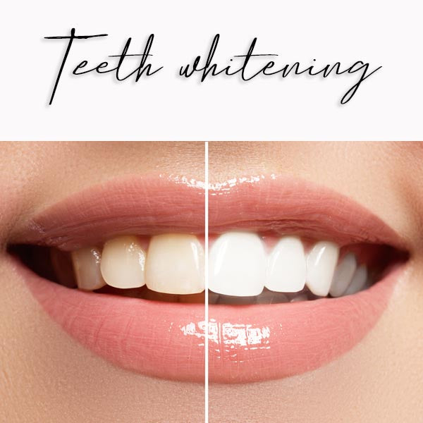 teeth whitening before and after 5-14 shades whiter